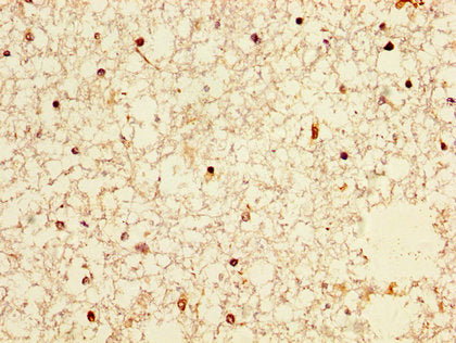 IHC image of NPAS4 Antibody diluted at 1:300 and staining in paraffin-embedded human brain tissue performed on a Leica BondTM system. After dewaxing and hydration, antigen retrieval was mediated by high pressure in a citrate buffer (pH 6.0). Section was blocked with 10% normal goat serum 30min at RT. Then primary antibody (1% BSA) was incubated at 4°C overnight. The primary is detected by a biotinylated secondary antibody and visualized using an HRP conjugated SP system.Rabbit anti-Human NPAS4 Polyclonal Antibody
