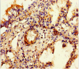Immunohistochemistry of paraffin-embedded human lung tissue using SULF1 Antibody at dilution of 1:100Rabbit anti-Human SULF1 Polyclonal Antibody
