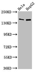 Western Blot | Positive WB detected in: Hela whole cell lysate, HepG2 whole cell lysate | All lanes: SULF1 antibody at 4μg/ml | Secondary | Goat polyclonal to rabbit IgG at 1/50000 dilution | Predicted band size: 102 kDa | Observed band size: 150 kDaRabbit anti-Human SULF1 Polyclonal Antibody