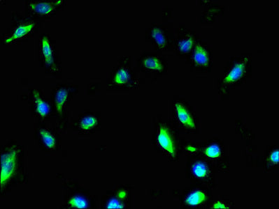 Immunofluorescent analysis of U251 cells using MMD2 Antibody at dilution of 1:100 and Alexa Fluor 488-congugated AffiniPure Goat Anti-Rabbit IgG(H+L)Rabbit anti-Human MMD2 Polyclonal Antibody