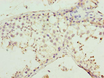 Immunohistochemistry of paraffin-embedded human testis tissue using MMD2 Antibody at dilution of 1:100Rabbit anti-Human MMD2 Polyclonal Antibody