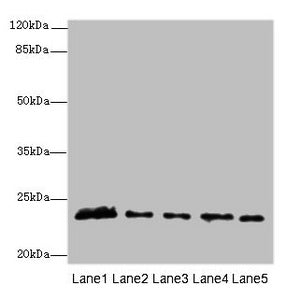 Western blot  | All lanes: MMD2 antibody at 3µg/ml  | Lane 1: Mouse brain tissue  | Lane 2: Mouse kidney tissue  | Lane 3: U251 whole cell lysate  | Lane 4: 293T whole cell lysate  | Lane 5: Mouse liver tissue  | Secondary  | Goat polyclonal to rabbit IgG at 1/10000 dilution  | Predicted band size: 32, 29, 23 kDa  | Observed band size: 23 kDa
