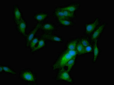 Immunofluorescent analysis of Hela cells using ASPM Antibody at dilution of 1:100 and Alexa Fluor 488-congugated AffiniPure Goat Anti-Rabbit IgG(H+L)Rabbit anti-Human ASPM Polyclonal Antibody