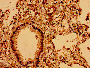 Immunohistochemistry of paraffin-embedded human lung tissue using ASPM Antibody at dilution of 1:100Rabbit anti-Human ASPM Polyclonal Antibody