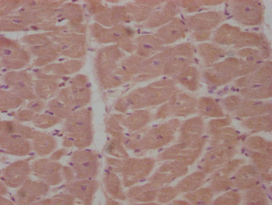 IHC image of APCDD1 Antibody diluted at 1:100 and staining in paraffin-embedded human heart tissue performed on a Leica BondTM system. After dewaxing and hydration, antigen retrieval was mediated by high pressure in a citrate buffer (pH 6.0). Section was blocked with 10% normal goat serum 30min at RT. Then primary antibody (1% BSA) was incubated at 4°C overnight. The primary is detected by a biotinylated secondary antibody and visualized using an HRP conjugated SP system.Rabbit anti-Human APCDD1 Polyclonal Antibody