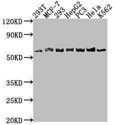 Western Blot | Positive WB detected in: 293T whole cell lysate, MCF-7 whole cell lysate, 293 whole cell lysate, HepG2 whole cell lysate, PC-3 whole cell lysate, Hela whole cell lysate, K562 whole cell lysate | All lanes: APCDD1 antibody at 1:1000 | Secondary | Goat polyclonal to rabbit IgG at 1/50000 dilution | Predicted band size: 59 kDa | Observed band size: 59 kDaRabbit anti-Human APCDD1 Polyclonal Antibody
