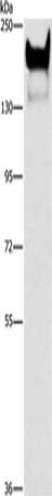 Gel: 6%SDS-PAGE, Lysate: 40 μg, Lane: Human metastatic malignant melanoma tissue, Primary antibody: CEACAM1 Antibody(CEACAM1 Antibody) at dilution 1/300, Secondary antibody: Goat anti rabbit IgG at 1/8000 dilution, Exposure time: 20 secondsRabbit anti-Human CEACAM1 Polyclonal Antibody