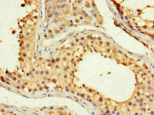 Immunohistochemistry of paraffin-embedded human testis tissue using FMNL3 Antibody at dilution of 1:100Rabbit anti-Human FMNL3 Polyclonal Antibody
