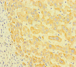 Immunohistochemistry of paraffin-embedded human liver tissue using P3H2 Antibody at dilution of 1:100Rabbit anti-Human P3H2 Polyclonal Antibody