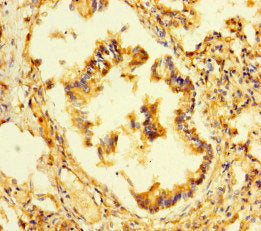 Immunohistochemistry of paraffin-embedded human lung tissue using P3H2 Antibody at dilution of 1:100Rabbit anti-Human P3H2 Polyclonal Antibody