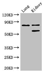 Western Blot | Positive WB detected in: Mouse lung tissue, Mouse kidney tissue | All lanes: LEPREL1 antibody at 3μg/ml | Secondary | Goat polyclonal to rabbit IgG at 1/50000 dilution | Predicted band size: 81, 61 kDa | Observed band size: 81, 61 kDaRabbit anti-Human P3H2 Polyclonal Antibody