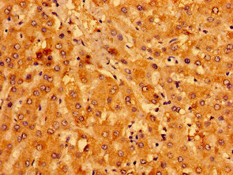 Immunohistochemistry of paraffin-embedded human liver tissue using MCAT Antibody at dilution of 1:100