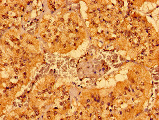 Immunohistochemistry of paraffin-embedded human adrenal gland tissue using MCAT Antibody at dilution of 1:100