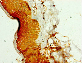 Immunohistochemistry of paraffin-embedded human skin tissue using SMYD4 Antibody at dilution of 1:100Rabbit anti-Human SMYD4 Polyclonal Antibody