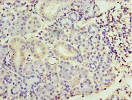 Immunohistochemistry of paraffin-embedded human pancreatic tissue using SMYD4 Antibody at dilution of 1:100Rabbit anti-Human SMYD4 Polyclonal Antibody