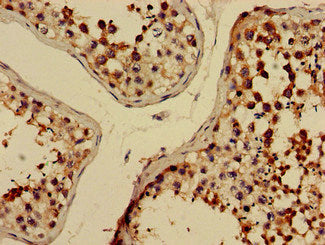 Immunohistochemistry of paraffin-embedded human testis tissue using ELMOD2 Antibody at dilution of 1:100Rabbit anti-Human ELMOD2 Polyclonal Antibody