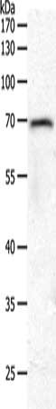 Gel: 10%SDS-PAGE, Lysate: 40 μg, Lane: Hela cells, Primary antibody: PXN Antibody(PXN Antibody) at dilution 1/700, Secondary antibody: Goat anti rabbit IgG at 1/8000 dilution, Exposure time: 3 minutesRabbit anti-Human PXN Polyclonal Antibody