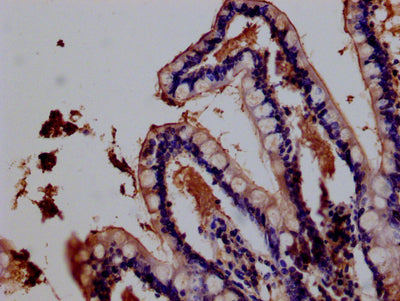 IHC image of IFNLR1 Antibody diluted at 1:200 and staining in paraffin-embedded human small intestine tissue performed on a Leica BondTM system. After dewaxing and hydration, antigen retrieval was mediated by high pressure in a citrate buffer (pH 6.0). Section was blocked with 10% normal goat serum 30min at RT. Then primary antibody (1% BSA) was incubated at 4°C overnight. The primary is detected by a Goat anti-rabbit polymer IgG labeled by HRP and visualized using 0.05% DAB.Rabbit anti-Human IFNLR1 Polyclonal Antibody