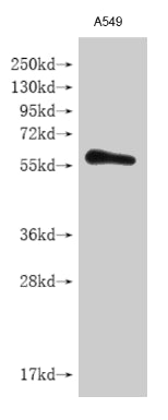 Western BlotPositive WB detected in A549 whole cell lysateAll lanes: IFNLR1 antibody at 1:2000SecondaryGoat polyclonal to rabbit IgG at 1/50000 dilutionPredicted band size: 58 kDaObserved band size: 58 kDaRabbit anti-Human IFNLR1 Polyclonal Antibody