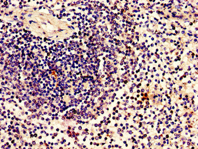 Immunohistochemistry of paraffin-embedded human spleen tissue using ZBTB8OS Antibody at dilution of 1:100Rabbit anti-Human ZBTB8OS Polyclonal Antibody