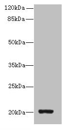 Western blot  | All lanes: ZBTB8OS antibody at 8µg/ml + HL60 whole cell lysate  | Secondary  | Goat polyclonal to rabbit IgG at 1/10000 dilution  | Predicted band size: 20, 16 kDa  | Observed band size: 20 kDaRabbit anti-Human ZBTB8OS Polyclonal Antibody