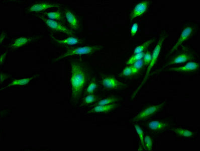 Immunofluorescence staining of Hela cells with SKA3 Antibody at 1:100, counter-stained with DAPI. The cells were fixed in 4% formaldehyde, permeabilized using 0.2% Triton X-100 and blocked in 10% normal Goat Serum. The cells were then incubated with the antibody overnight at 4°C. The secondary antibody was Alexa Fluor 488-congugated AffiniPure Goat Anti-Rabbit IgG(H+L).Rabbit anti-Human SKA3 Polyclonal Antibody