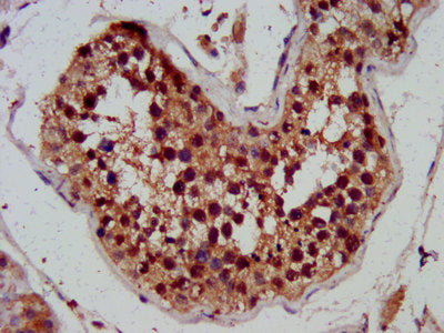 IHC image of the antibody diluted at 1:300 and staining in paraffin-embedded human testis tissue performed on a Leica BondTM system. After dewaxing and hydration, antigen retrieval was mediated by high pressure in a citrate buffer (pH 6.0). Section was blocked with 10% normal goat serum 30min at RT. Then primary antibody (1% BSA) was incubated at 4°C overnight. The primary is detected by a biotinylated secondary antibody and visualized using an HRP conjugated SP system.Rabbit anti-Human SKA3 Polyclonal Antibody