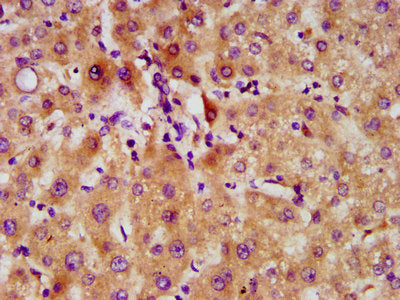IHC image of FAM20C Antibody diluted at 1:500 and staining in paraffin-embedded human liver tissue performed on a Leica BondTM system. After dewaxing and hydration, antigen retrieval was mediated by high pressure in a citrate buffer (pH 6.0). Section was blocked with 10% normal goat serum 30min at RT. Then primary antibody (1% BSA) was incubated at 4°C overnight. The primary is detected by a biotinylated secondary antibody and visualized using an HRP conjugated SP system.Rabbit anti-Human FAM20C Polyclonal Antibody