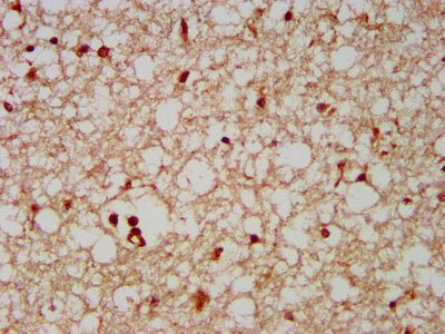 IHC image of FAM20C Antibody diluted at 1:500 and staining in paraffin-embedded human brain tissue performed on a Leica BondTM system. After dewaxing and hydration, antigen retrieval was mediated by high pressure in a citrate buffer (pH 6.0). Section was blocked with 10% normal goat serum 30min at RT. Then primary antibody (1% BSA) was incubated at 4°C overnight. The primary is detected by a biotinylated secondary antibody and visualized using an HRP conjugated SP system.Rabbit anti-Human FAM20C Polyclonal Antibody