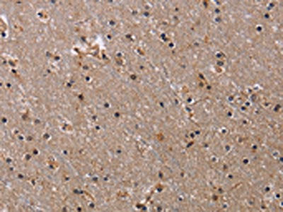 The image on the left is immunohistochemistry of paraffin-embedded Human brain  tissue using NIT1 Antibody(NIT1 Antibody) at dilution 1/30, on the right is treated with fusion protein. (Original magnification: ×200)Rabbit anti-Human NIT1 Polyclonal Antibody