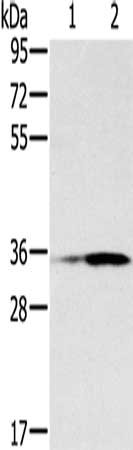 Gel: 8%SDS-PAGE, Lysate: 40 μg, Lane 1-2: Human placenta tissue, Human fetal liver tissue, Primary antibody: NIT1 Antibody(NIT1 Antibody) at dilution 1/400, Secondary antibody: Goat anti rabbit IgG at 1/8000 dilution, Exposure time: 5 minutesRabbit anti-Human NIT1 Polyclonal Antibody