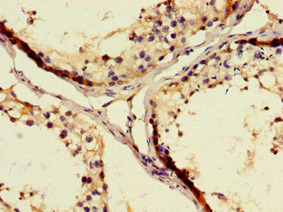 Immunohistochemistry of paraffin-embedded human testis tissue using WFDC8 Antibody at dilution of 1:100Rabbit anti-Human WFDC8 Polyclonal Antibody