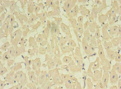 Immunohistochemistry of paraffin-embedded human heart tissue using NOSTRIN Antibody at dilution of 1:100Rabbit anti-Human NOSTRIN Polyclonal Antibody