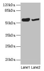 Western blot  | All lanes: NOSTRIN antibody at 6µg/ml  | Lane 1: Mouse heart tissue  | Lane 2: Mouse brain tissue  | Secondary  | Goat polyclonal to rabbit IgG at 1/10000 dilution  | Predicted band size: 58, 55, 49, 65 kDa  | Observed band size: 58 kDaRabbit anti-Human NOSTRIN Polyclonal Antibody