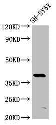 Western Blot  | Positive WB detected in: SH-SY5Y whole cell lysate  | All lanes: MKX antibody at 6µg/ml  | Secondary  | Goat polyclonal to rabbit IgG at 1/50000 dilution  | Predicted band size: 40 kDa  | Observed band size: 40 kDa
