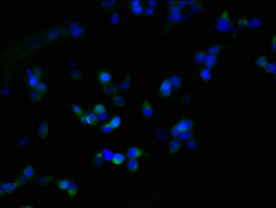 Immunofluorescent analysis of 293T cells using ZDHHC23 Antibody at dilution of 1:100 and Alexa Fluor 488-congugated AffiniPure Goat Anti-Rabbit IgG(H+L)Rabbit anti-Human ZDHHC23 Polyclonal Antibody