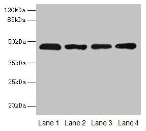 Western blot  | All lanes: ZDHHC23 antibody at 8µg/ml  | Lane 1: 293T whole cell lysate  | Lane 2: Mouse brain tissue  | Lane 3: A549 whole cell lysate  | Lane 4: Human placenta tissue  | Secondary  | Goat polyclonal to rabbit IgG at 1/10000 dilution  | Predicted band size: 46 kDa  | Observed band size: 46 kDaRabbit anti-Human ZDHHC23 Polyclonal Antibody