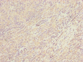 Immunohistochemistry of paraffin-embedded human tonsil tissue using CEP57L1 Antibody at dilution of 1:100Rabbit anti-Human CEP57L1 Polyclonal Antibody