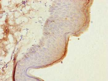 Immunohistochemistry of paraffin-embedded human skin tissue using CEP57L1 Antibody at dilution of 1:100Rabbit anti-Human CEP57L1 Polyclonal Antibody