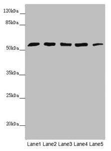 Western blot  | All lanes: CEP57L1 antibody at 6.26µg/ml  | Lane 1: CEM whole cell lysate  | Lane 2: 293T whole cell lysate  | Lane 3: Hela whole cell lysate  | Lane 4: Jurkat whole cell lysate  | Lane 5: A549 whole cell lysate  | Secondary  | Goat polyclonal to rabbit IgG at 1/10000 dilution  | Predicted band size: 54, 46 kDa  | Observed band size: 54 kDaRabbit anti-Human CEP57L1 Polyclonal Antibody