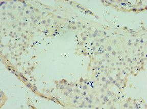 Immunohistochemistry of paraffin-embedded human testis tissue using SPAG16 Antibody at dilution of 1:100Rabbit anti-Human SPAG16 Polyclonal Antibody