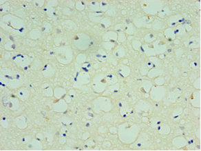 Immunohistochemistry of paraffin-embedded human brain tissue using SPAG16 Antibody at dilution of 1:100Rabbit anti-Human SPAG16 Polyclonal Antibody