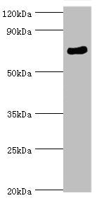 Western blot | All lanes: SPAG16 antibody at 6μg/ml + Mouse brain tissue | Secondary | Goat polyclonal to rabbit IgG at 1/10000 dilution | Predicted band size: 71, 51, 30, 21, 40 kDa | Observed band size: 71 kDaRabbit anti-Human SPAG16 Polyclonal Antibody