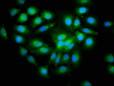 Immunofluorescence staining of A549 cells with SHISA5 Antibody at 1:200, counter-stained with DAPI. The cells were fixed in 4% formaldehyde, permeabilized using 0.2% Triton X-100 and blocked in 10% normal Goat Serum. The cells were then incubated with the antibody overnight at 4°C. The secondary antibody was Alexa Fluor 488-congugated AffiniPure Goat Anti-Rabbit IgG(H+L).Rabbit anti-Human SHISA5 Polyclonal Antibody