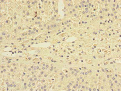 Immunohistochemistry of paraffin-embedded human adrenal gland tissue using the antibody at dilution of 1:100Rabbit anti-Human SHISA5 Polyclonal Antibody