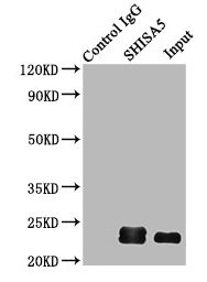 Immunoprecipitating SHISA5 in HepG2 whole cell lysate  | Lane 1: Rabbit control IgG (1µg) instead of SHISA5 Antibody in HepG2 whole cell lysate. For western blotting, a HRP-conjugated Protein G antibody was used as the secondary antibody (1/2000)  | Lane 2: SHISA5 Antibody (6µg) + HepG2 whole cell lysate (500µg)  | Lane 3: HepG2 whole cell lysate (10µg)Rabbit anti-Human SHISA5 Polyclonal Antibody