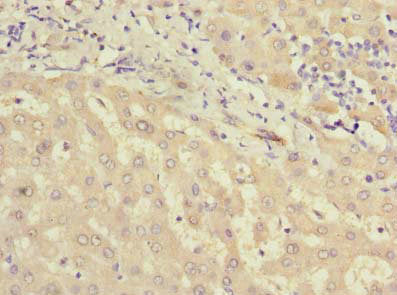 Immunohistochemistry of paraffin-embedded human liver tissue using MIER2 Antibody at dilution of 1:100
