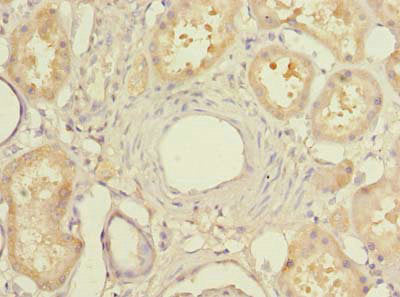 Immunohistochemistry of paraffin-embedded human kidney tissue using MIER2 Antibody at dilution of 1:100