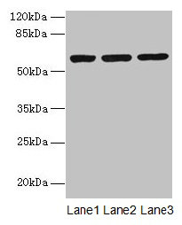 Western blot  | All lanes: MIER2 antibody at 4µg/ml  | Lane 1: Jurkat whole cell lysate  | Lane 2: HepG2 whole cell lysate  | Lane 3: A549 whole cell lysate  | Secondary  | Goat polyclonal to rabbit IgG at 1/10000 dilution  | Predicted band size: 60 kDa  | Observed band size: 60 kDa