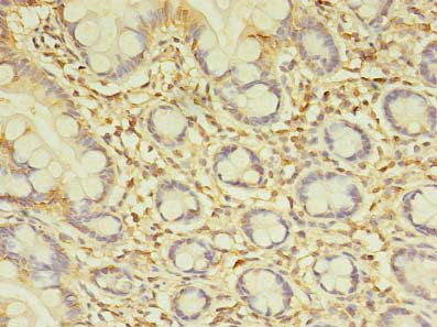 Immunohistochemistry of paraffin-embedded human small intestine tissue using SPIC Antibody at dilution of 1:100